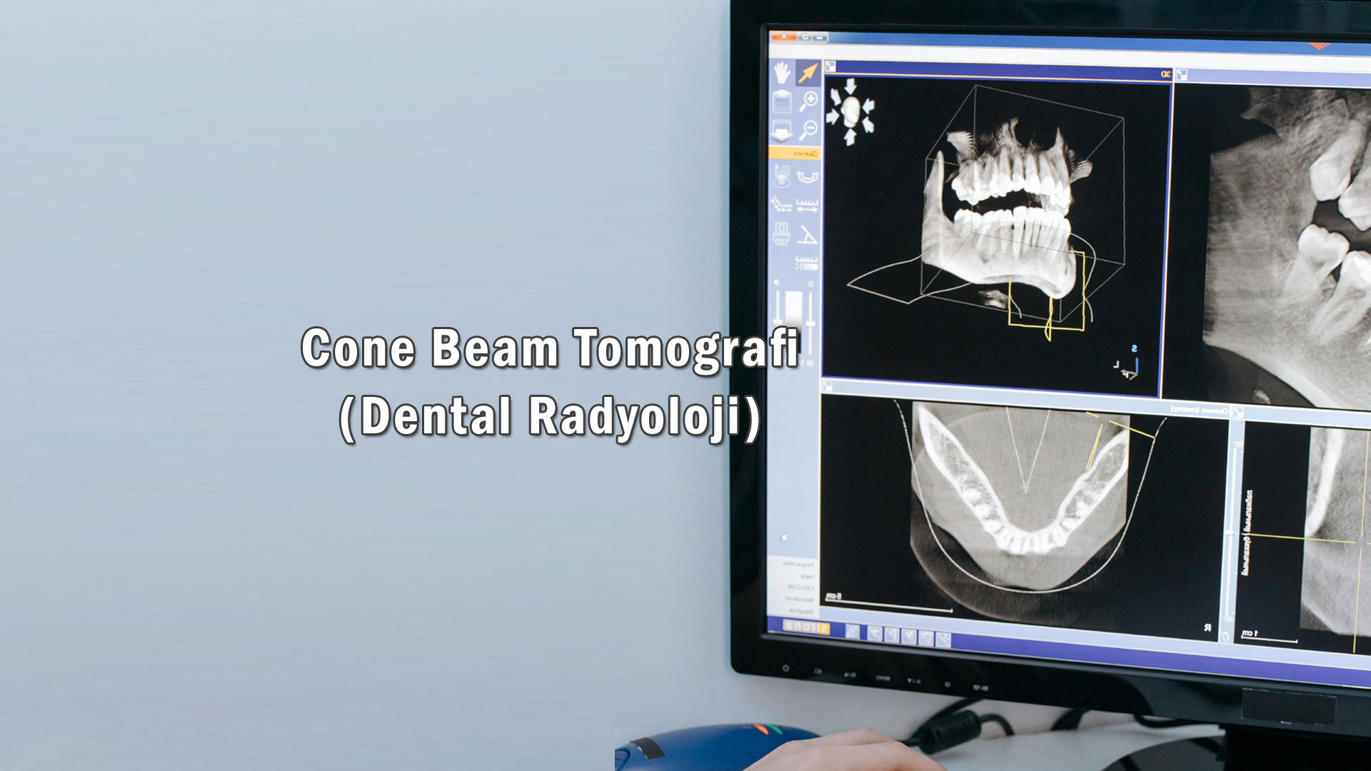Cone Beam Tomografi 